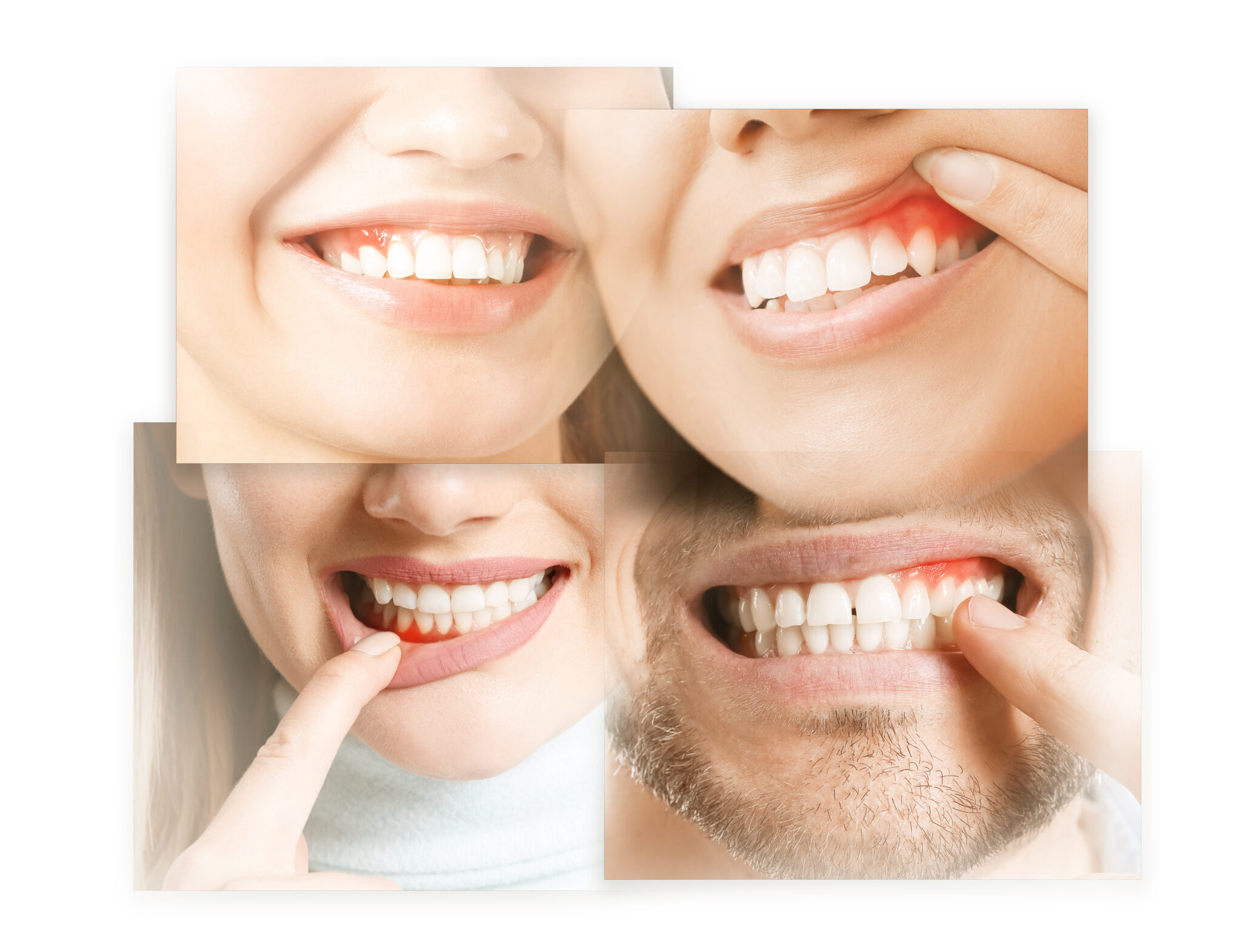 The Warning Signs Of Gum Disease Rochester Mn