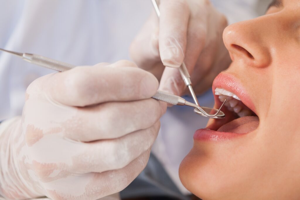 rochester dental checkup