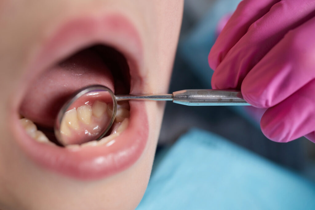 rochester dental exams