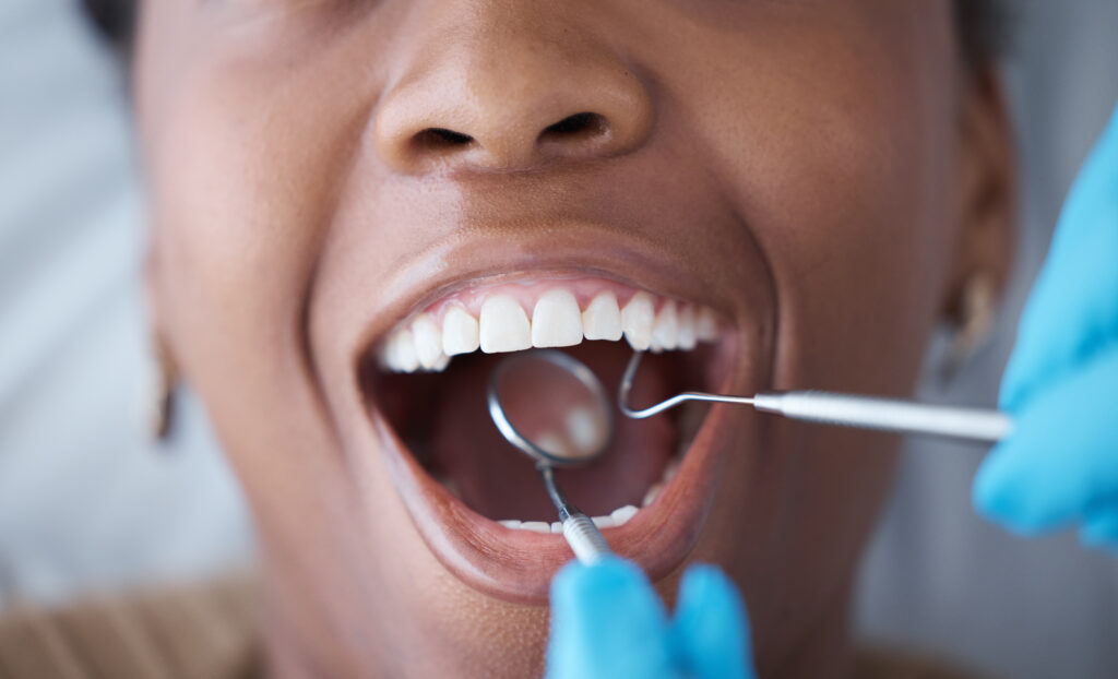 rochester dental cleaning