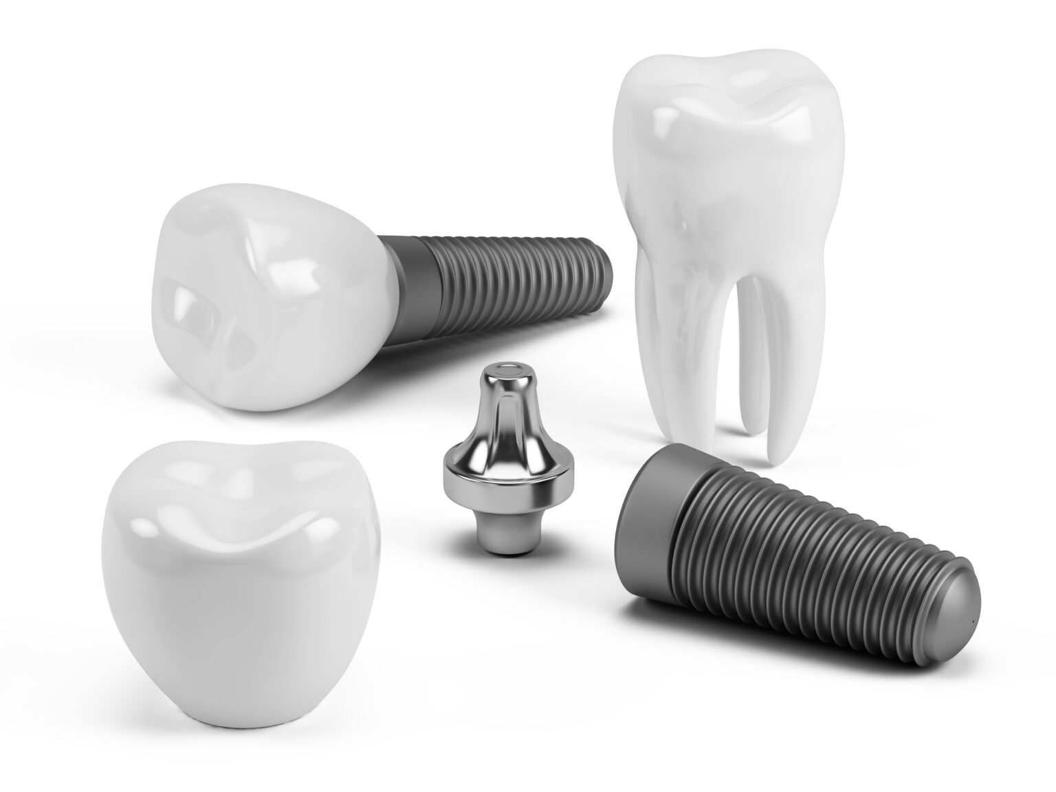 Replacing Individual Missing Teeth | Rochester, MN