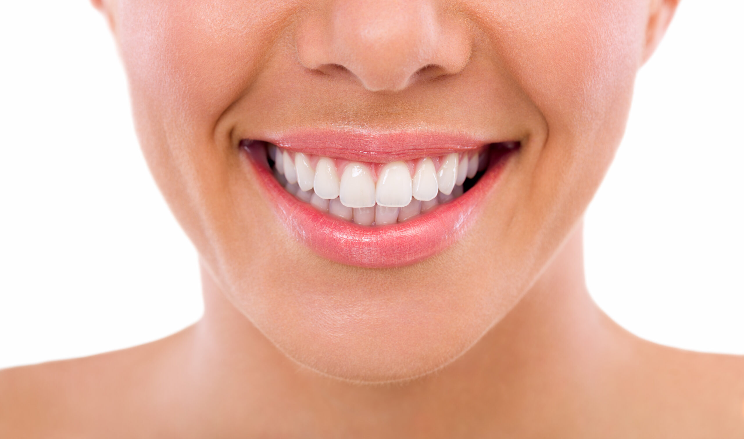 The Cosmetic Issues Veneers Can Improve Rochester, MN