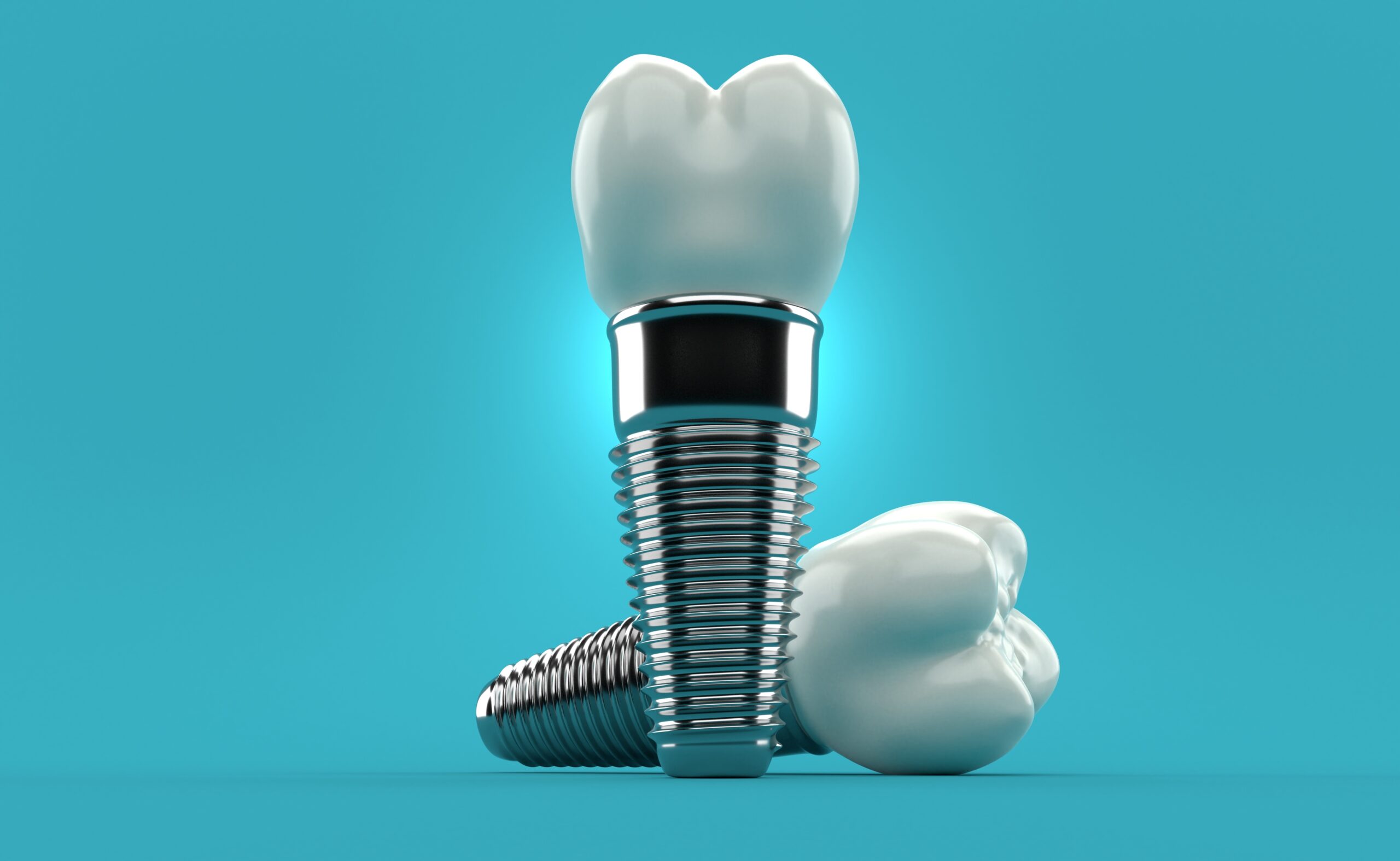 what-makes-dental-implants-look-natural-rochester-mn