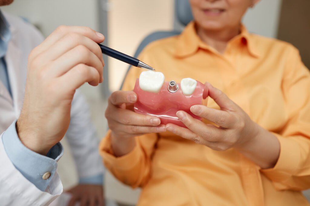 rochester dental implant benefits